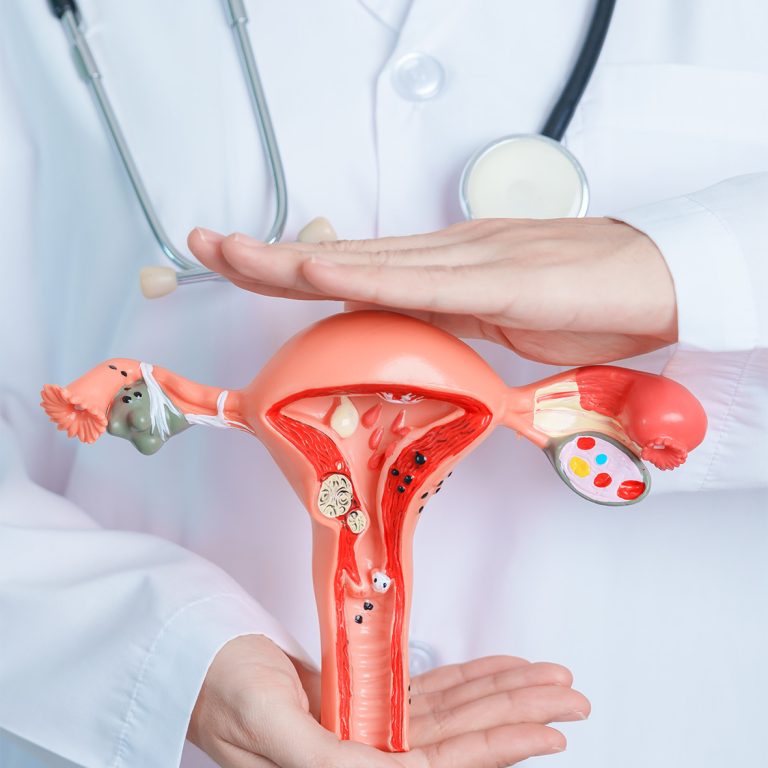 gynecological-disorder